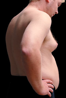Do you have man boobs? Yes, then this article is for you
