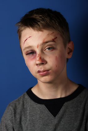 Boy: Battered & Bruised