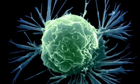 Innocent Looking Breast Cancer Cell