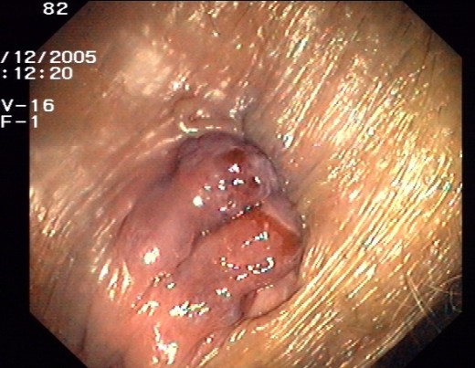 Needs maggots. Maybe I'll invent a maggot powder, call it Preparation M.