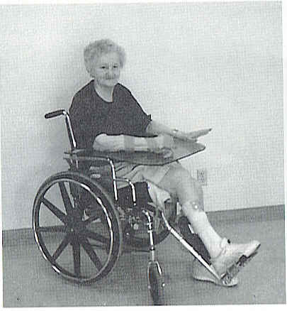 Stroke patient wearing splint with arm on lapboard to keep it in place.