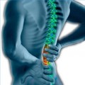 The Importance of Reversal of Cervical and Lumbar Lordosis  Healdove