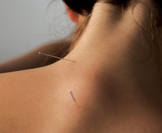 Acupuncture is a precision profession, and you must become fully trained before you can practice on other people.