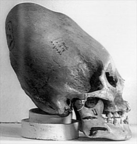 Inca skull
