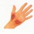 Abrasion