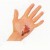 Laceration