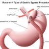 Bariatric Surgery profile image