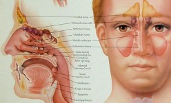 Sinus Problems