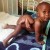 baby with conjoined twin protruding from buttocks baby with conjoined twin protruding from buttocks