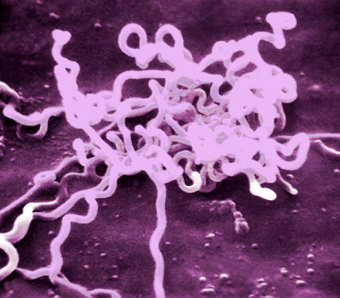 spiral-shaped bacteria