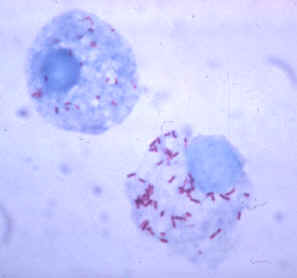 often changes in shape; can be sphere-shaped or rod-shaped bacteria