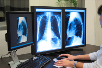 HubPages profile picture for @radiologist