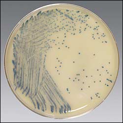 This is what Staphylococcus MRSA looks like grown in the lab