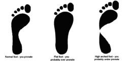 Determine Foot Pronation: What Type of Pronator Are You? | Healdove