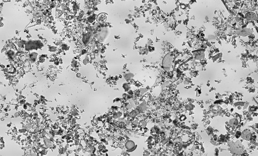 This image of diatomaceous earth particles in water is at a scale of 6.236 pixels/m, the entire image covers a region of approximately 1.13 by 0.69 mm.