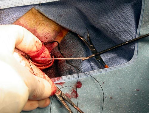 Heartworm extraction via jugular vein