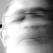 Arterial profile image