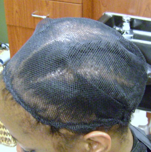 The net can cover either the entire head or just the affected area. 
