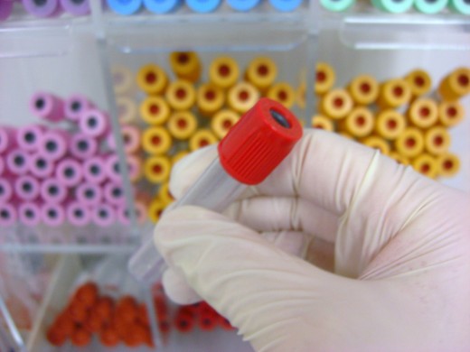 Blood tests are one step in detecting PCOS.