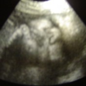 midwife-downunder profile image