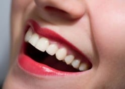 How to whiten your teeth and keep them white - at home, zoom, dentist & natural tooth whitening you can do at home free