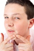 Getting Rid of Face and other Acne - Treatment, Causes, and Prevention for Tween and Teen Boys