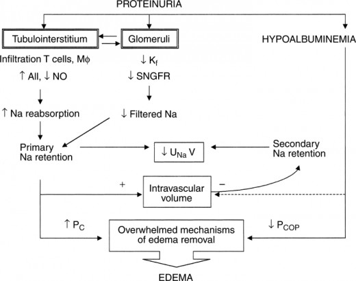 Mechanism of Edema and edema removal