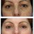 before & after pictures before & after pictures