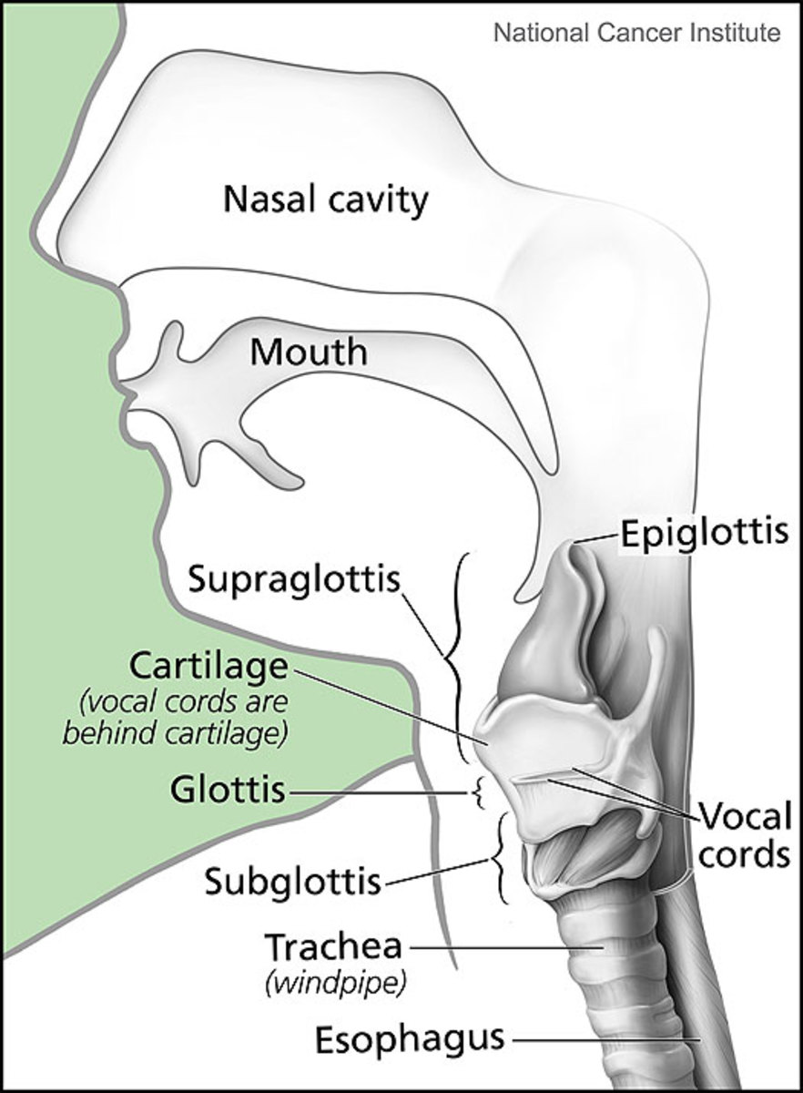 What Is Laryngeal or Larynx Cancer ?