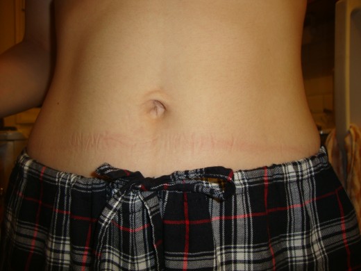 Belly After Belly