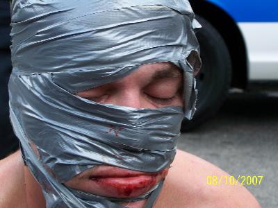 Kasey Kazee of Ashland, Kentucky duct taped his face by way of disguise.