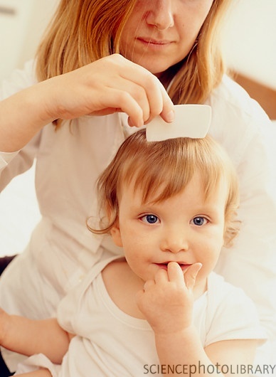 removing head lice on young children