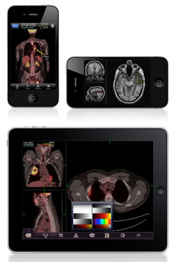 Scans on the iPad, iPhone