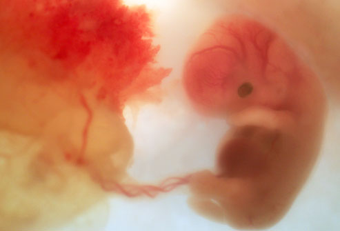 Eight weeks gestation. You can clearly see the fetus,umbilical cord and placenta