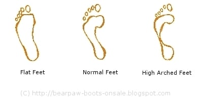 Wet Foot Test-Types of Feet