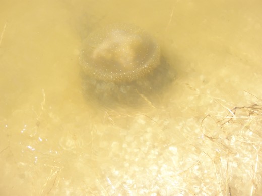 People with severe depression expect things to be worse that they end up being. People with mild depression are relatively accurate when predicting future events. They see the world as it is. People with severe depression expect things to be worse that they end up being. People with mild depression are relatively accurate when predicting future events. They see the world as it is.