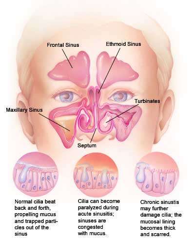 http://www.genericlook.com/diseases/Nasal-Congestion/