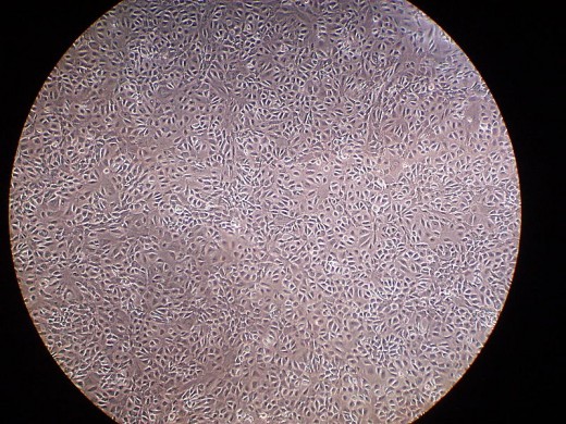 Mesothelium cells