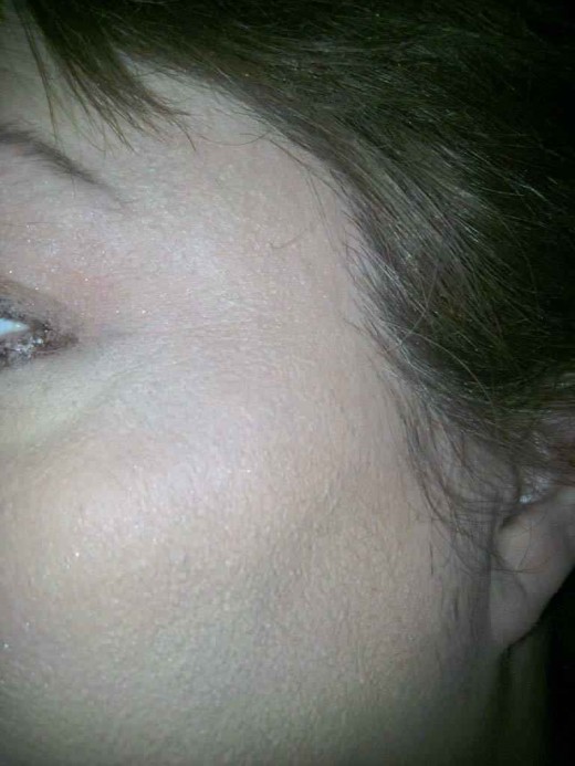 Left cheekbone after Sheer Cover concealer and Mineral Foundation have been applied in my own custom blended shades!