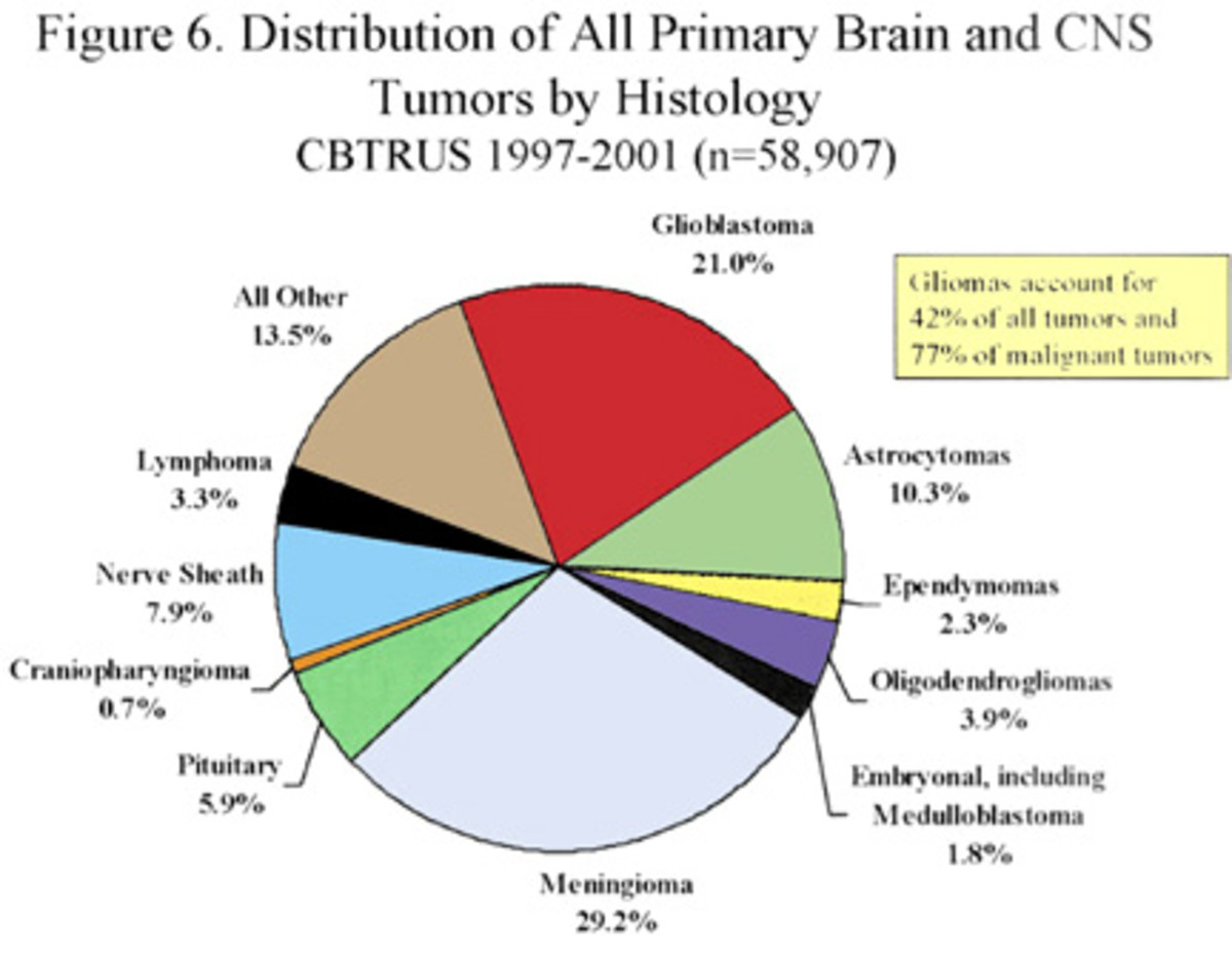 Brain Cancer Chart