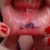 Blurred lip tattoo