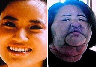 Horrors Of Cosmetic Surgery