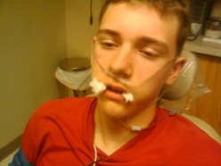 Health Insurance Does Not Pay for Wisdom Teeth Extractions