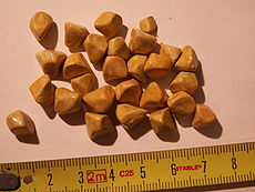 What gallstones look like. They are mainly composed of hardened cholesterol.  Icky, huh?