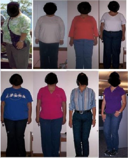 After bariatric surgery