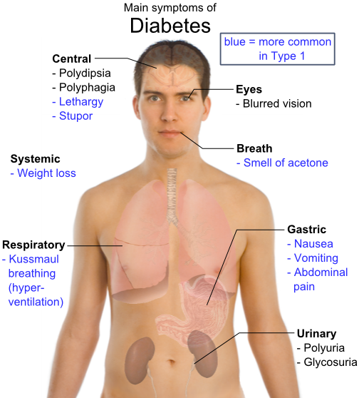 Diabetes Symptoms