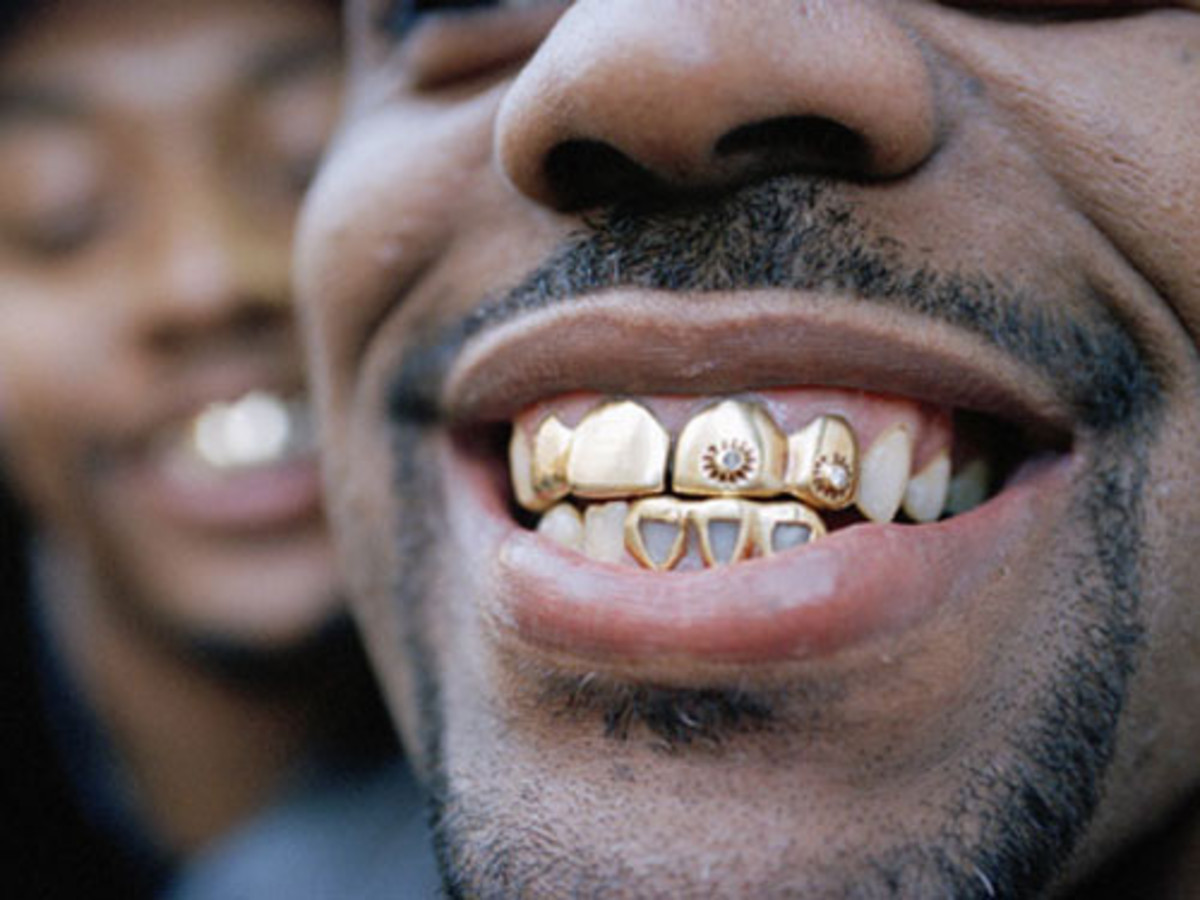 What The Heck Are Dental Grillz? | HubPages Grillz That Look Like Real Teeth