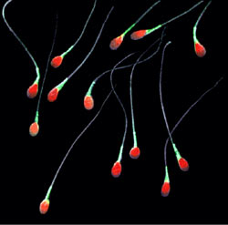 False colored Image of Sperm Cells. Source: Public Domain 