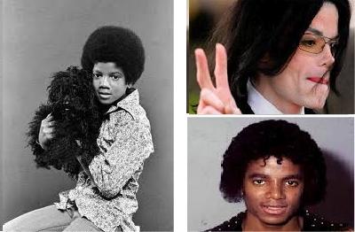 Michael Jackson before and after surgery