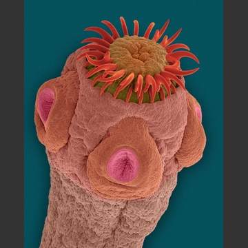 tapeworm